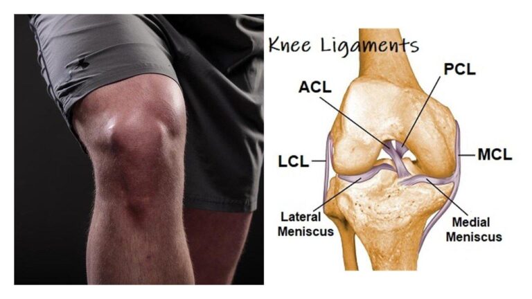 Ligament Injury Operation: A Crucial Step Towards Recovery